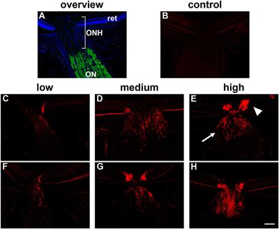 Investigations into Hypoxia and Oxidative Stress at the Optic Nerve Head in a Rat Model of Glaucoma